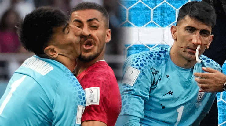 İngiltere – İran maçında korkutan çarpışma